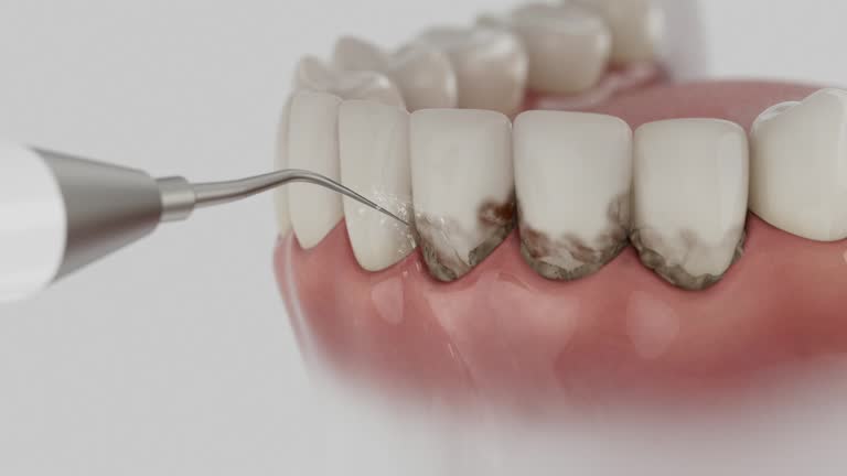 Reliable Tooth Extraction contractor in Schley County County, GA by Dentist Open Now